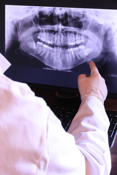 Best Mobile Emergency Dentist in Bolingbrook, IL