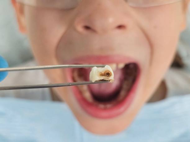 Best Pediatric Emergency Dentist in Bolingbrook, IL